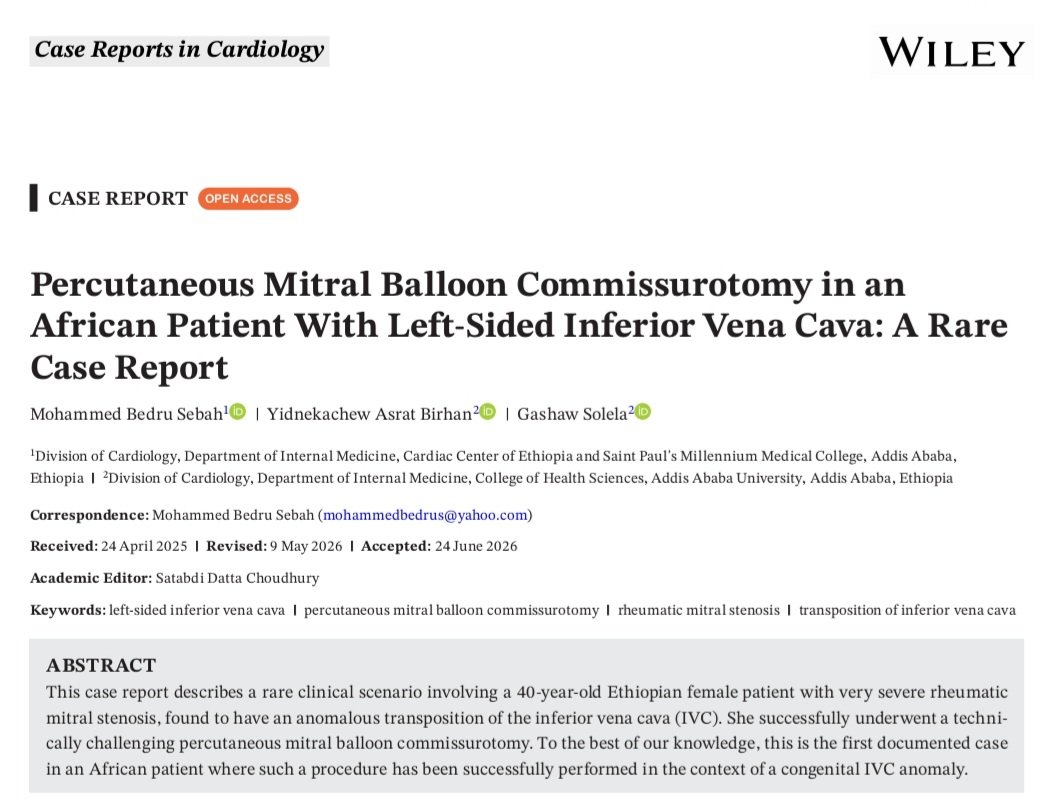gashawsol's tweet photo. 🫀New Publication Alert!

"Percutaneous Mitral Balloon Commissurotomy in an African Patient With Left-Sided Inferior Vena Cava: A Rare Case Report."

This is the 1st documented successful PMBC in an African patient with a left-sided IVC.

https://t.co/pbegrQfIE7… https://t.co/6UcREUIXMW