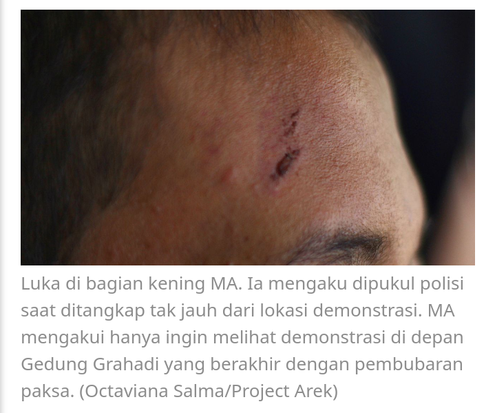 BerhakProtes's tweet photo. Update: 10 orang masih ditahan, termasuk 2 orang anak (<18 tahun)!

Mereka juga menjadi korban pemukulan oleh aparat kepolisian.

Selengkapnya:
https://t.co/UuPcKYwEs7 https://t.co/8Ai5CquBRX