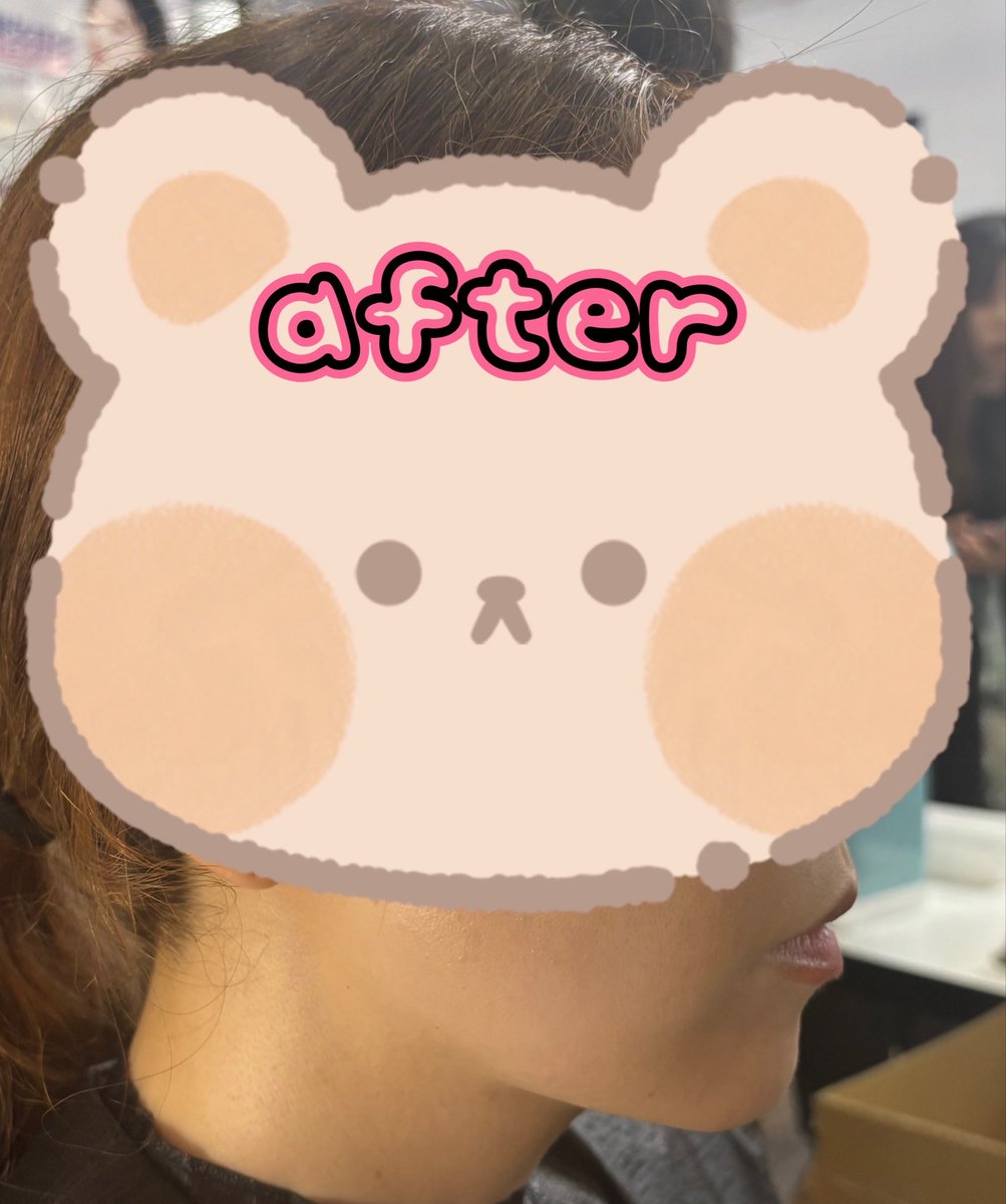 ICCULBOR's tweet photo. ルナグランデさんの脂肪溶解、運よく予約が取れて体験してきました✨
短い施術なのに、口横のたるみが目に見えて軽くなっていてびっくり…！
心地いい温度だったのも良かったです。
 #ルナグランデ #注射を使わない脂肪溶解  #びゅーふる https://t.co/RyNDDFAVDg