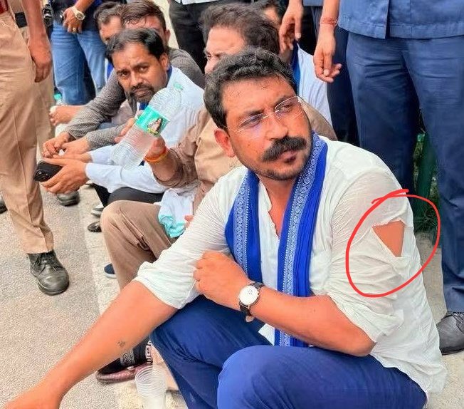 raviparmarIN's tweet photo. लाठी खाई, शर्ट फटी, अपमान सहा, पुलिस प्रशासन से टकराव हुआ और अंत में केतन लाल के परिवार से मुलाक़ात हो गई, 🔥🔥 

याद रहे केतन लाल की हत्या सुवर्णो ने इसलिए कर दी क्योंकि उसकी दोस्ती एक सुवर्ण समुदाय के लड़के से हो गई थी,

केतन लाल के पैरों में कील ठोंकी गई थी, उसे इतना बेरहमी से मारा की शरीर के अंदर सारी हड्डियां फैक्चर हो गई थी, तड़पते हुए उसकी दर्दनाक मौत हो गई,

कुछ लोगों को लगता है रील बाजी कर रहा है, लेकिन हक़ीक़त यह है कि अपनों के साथ खड़ा होने के लिए शेर का कलेजा चाहिए,

चंद्रशेखर शेर का कलेजा लेकर पैदा हुआ है, उसकी बराबरी सोने का चमचा लेकर पैदा हुए और महलों से आंदोलन चलाने वाले नहीं कर पाएंगे 🔥🔥
