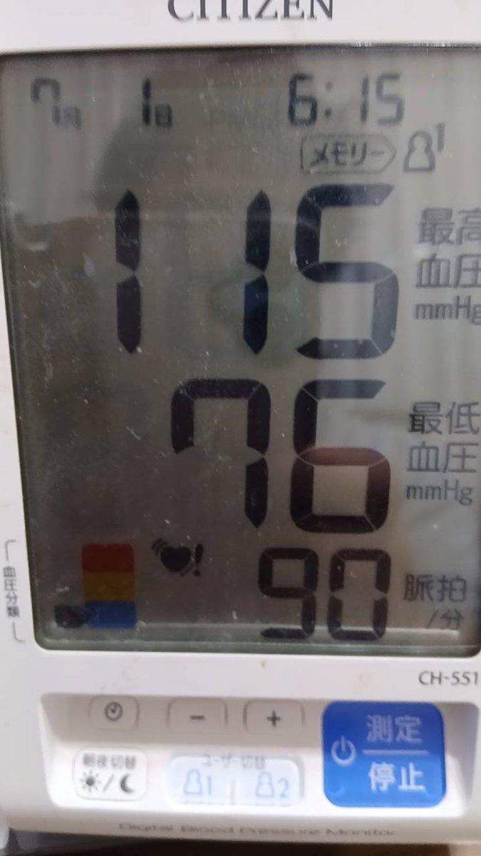 moke_bm's tweet photo. 血圧は良いのだが，6月27/28/29/30，7/1と5日連続脈が飛び続けている… https://t.co/IBlprJUKcO