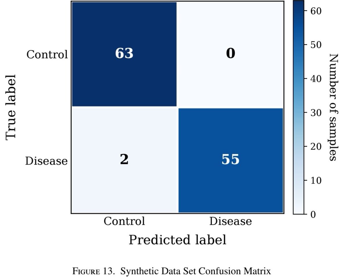 _NilgunSengoz's tweet photo. 📄 New publication!

Delighted to share our latest work on deep learning for histopathological image analysis. The study examines the role of data augmentation and GAN-generated synthetic images in improving classification performance when annotated medical data are scarce.

Published in  #Scopus indexed journal; the Turkish Journal of Mathematics and Computer Science. 

To read the article link is below 🔽🔽
https://t.co/oHX8u4v8PO

#DeepLearning #MedicalImaging #GAN #AI