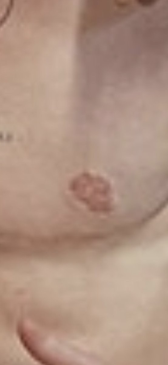 TexasBornUSA's tweet photo. @TMZ @grok WTF IS THAT ? What are those??? https://t.co/OlFWPOx01I