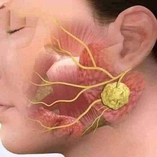 MeryLuz21226's tweet photo. 🧠 El nervio vago, tu superpoder antiestrés
1/4

¿Sabías que tienes un nervio que funciona como “freno natural” del estrés?  

Se llama nervio vago (nervio craneal X). Es el más largo del cuerpo y conecta tu cerebro directamente con corazón, pulmones, estómago e intestinos.  

Es el protagonista del sistema parasimpático: el que te ayuda a relajarte, digerir y recuperarte. 🌟