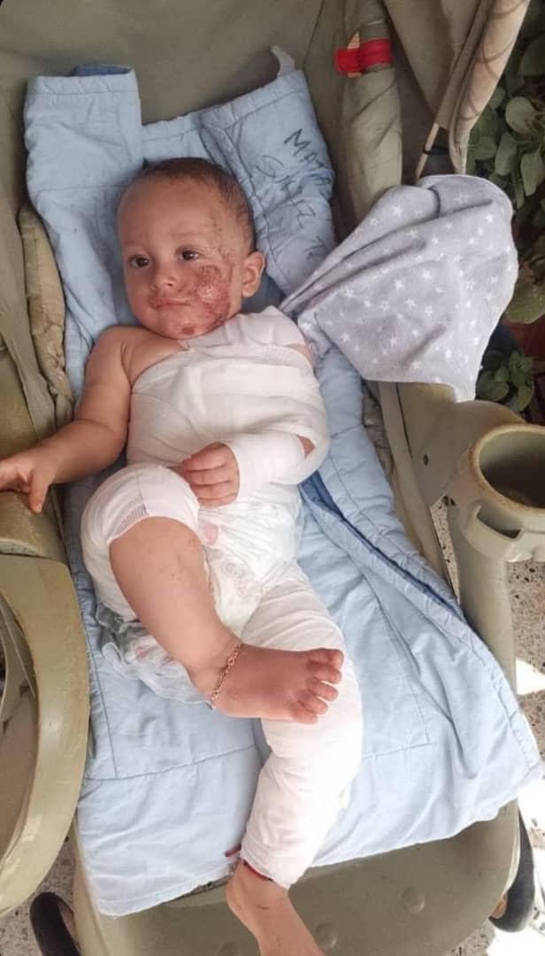 lizardo_jesus's tweet photo. Bebé de 10 meses lamentablemente su mamá falleció en el terremoto, actualmente tiene fractura de clavícula. Por favor necesitamos leche, pañales. Toda la ayuda que nos brinden es bienvenida, sino pueden donar pueden ayudarnos a difundir🙏🏻 NÚMERO 04120226115. https://t.co/781i0q1slT