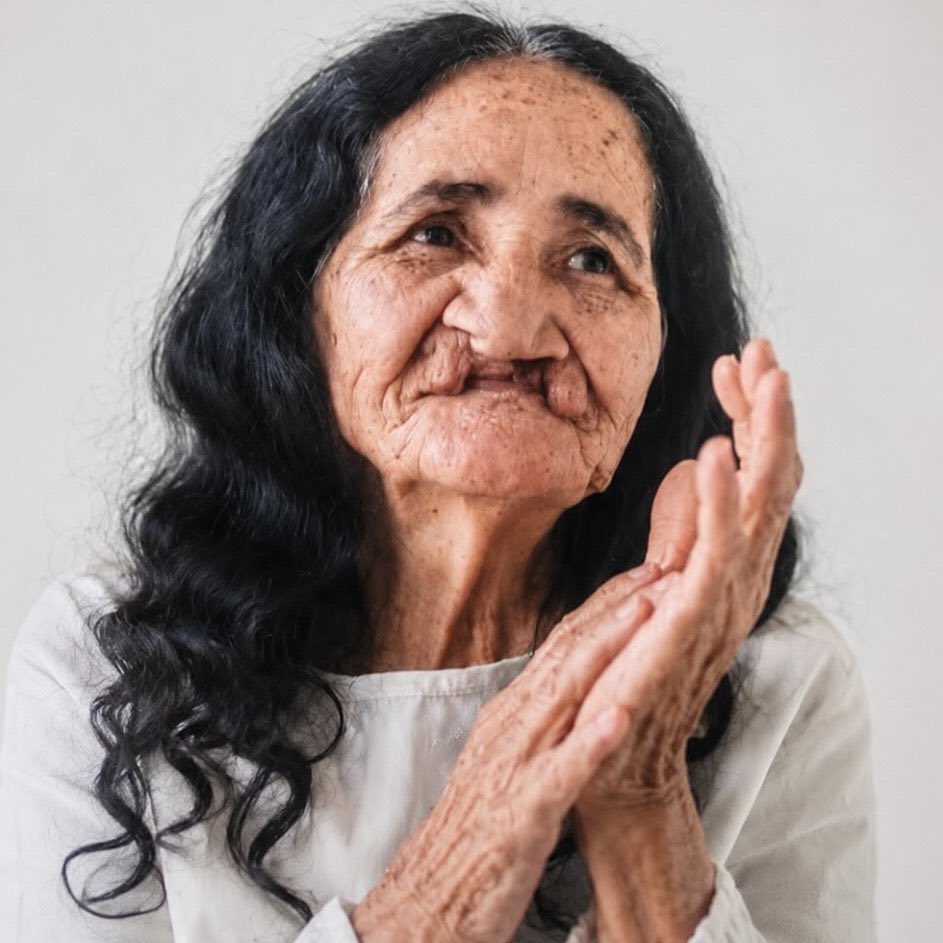 Indie5051's tweet photo. Cirugía gratuita permitió que una anciana realizara, a los 67 años, el sueño de usar lápiz labial por primera vez. https://t.co/xbYssgfdlQ