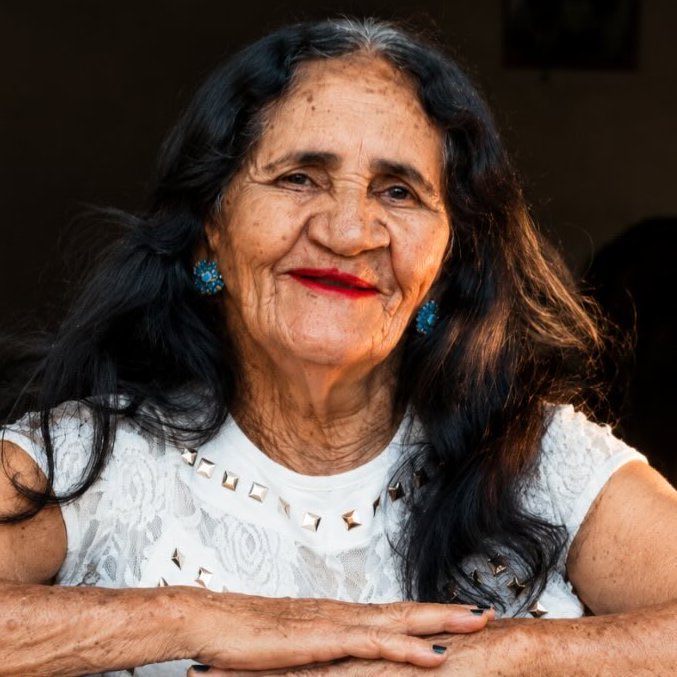 Indie5051's tweet photo. Cirugía gratuita permitió que una anciana realizara, a los 67 años, el sueño de usar lápiz labial por primera vez. https://t.co/xbYssgfdlQ
