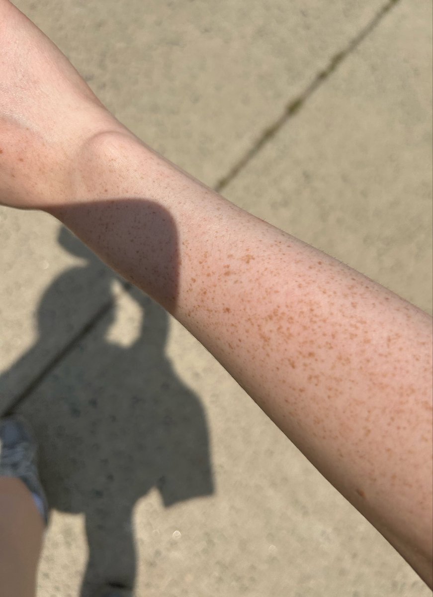 cherry_omad's tweet photo. i look tan for a ginger https://t.co/TWkUTyi8uD