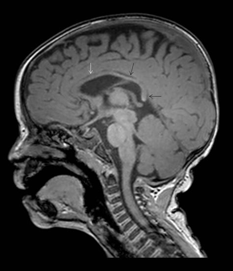 forallcurious's tweet photo. 🚨: Screen time destroys toddler's brains. For every 30 minutes, the risk of speech delay increases 49%. https://t.co/9iP7p1Hyc1