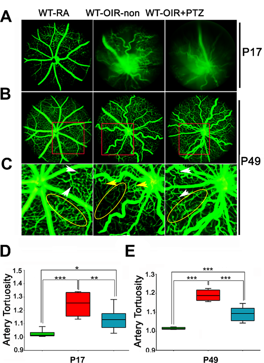 ARVOiovs's tweet photo. First article in the Premature Birth issue https://t.co/la1gfK0zYv by Jing Wang et al. at the Medical College of Georgia finds that sigma 1 receptor activation coordinates metabolic stress responses to protect retinal vasculature in ischemic retinopathy. 
https://t.co/wnAxkJzblS https://t.co/Vw9NP7ABRc