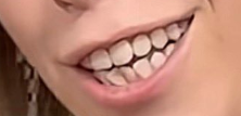 SaulAlessio's tweet photo. @3RLane @amuse you going to tell me Krypton, has advance tech, space ships, super smart automatons.. but never developed a orthodontist. Her teeth are worst then Austin Powers, and his was done as a joke. So yeah i think that is ugly. it's not about nudity, the outfit was fine. it's the actress https://t.co/xSbMaWhgpT