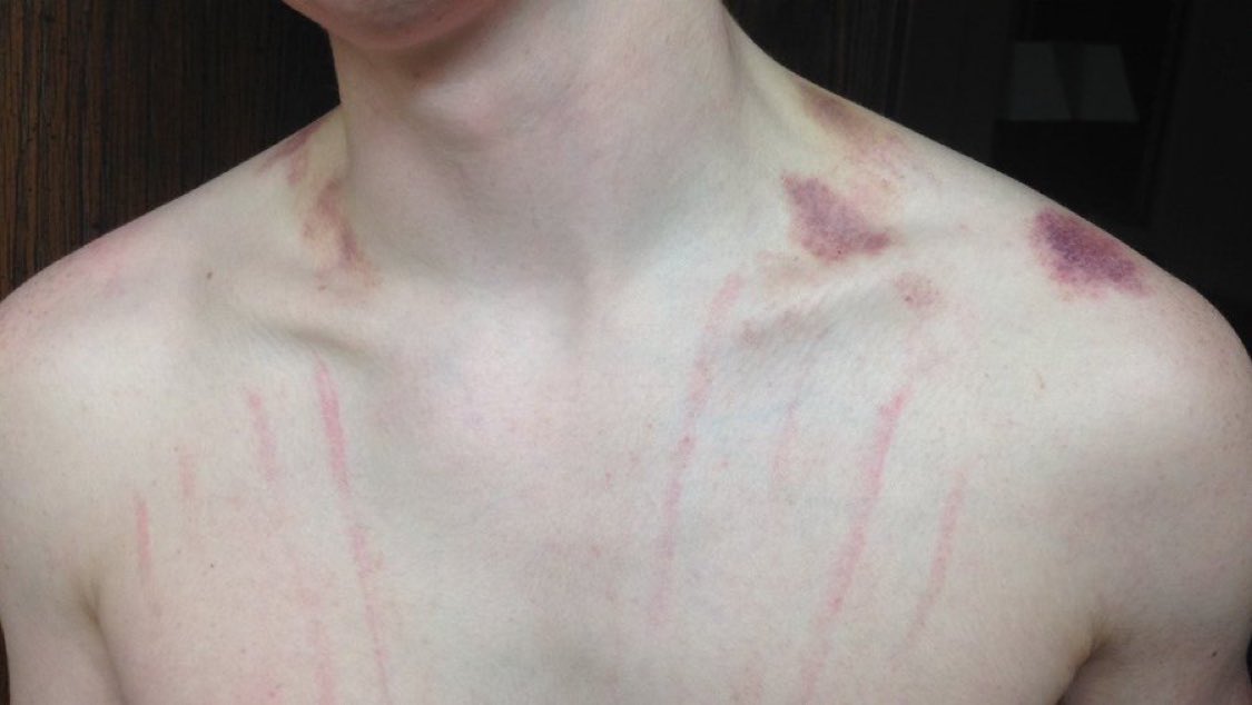 dxb_bbaby's tweet photo. wanna leave my marks on you🔥 https://t.co/P7ImLqLccp