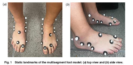 ASMEJournals's tweet photo. The effects of #walking speed on 3D foot rigidity and multisegment coordination. https://t.co/Msmpz8Incy
#biomechanics #kinematics https://t.co/xiF5n5eiZI