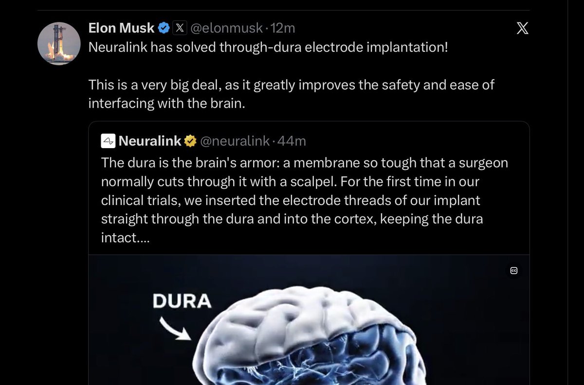 jimstewartson's tweet photo. Good news everyone, the man who deliberately condemned 14 million Black people to death has a new way to drill a hole in your head!

This way people can “couple directly” with Grok.

You don’t understand how dark his “endgame” really is. https://t.co/UAWWMEgpsj