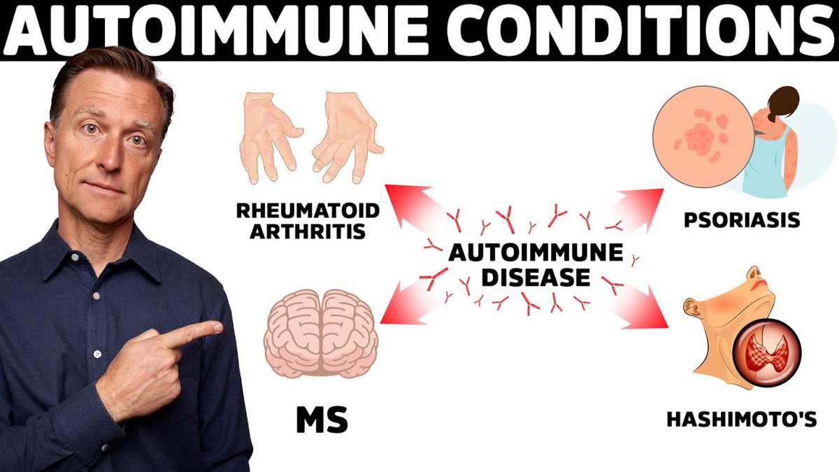 dr_ericberg's tweet photo. Autoimmune disease may not start where most people think.

Hidden triggers can disrupt immune control long before symptoms appear.

Follow the chain back to what may be setting the reaction in motion.

https://t.co/5eN7Ydrwpk

Dr. Eric Berg, DC, not MD; information only https://t.co/87dY9Dl3qo
