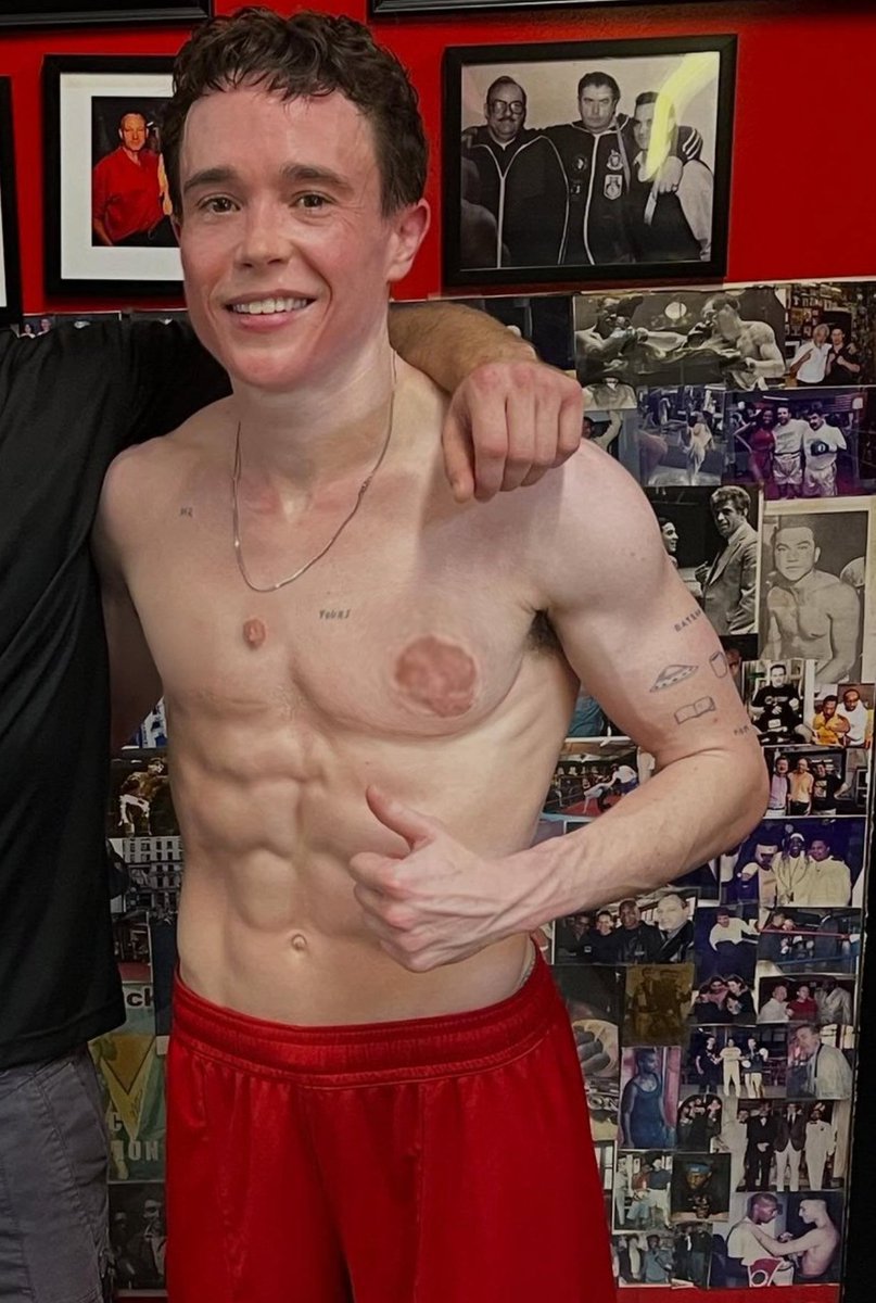 Tesla7771's tweet photo. That plastic surgeon really botched the Nipples 🤮 https://t.co/dSMWdklqq3