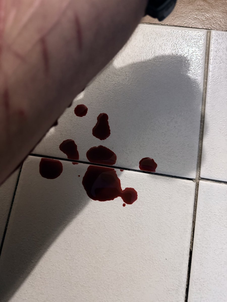 8Pickproofsnake's tweet photo. ¿Vale la pena incluso morir? https://t.co/OLV1NNHDhz