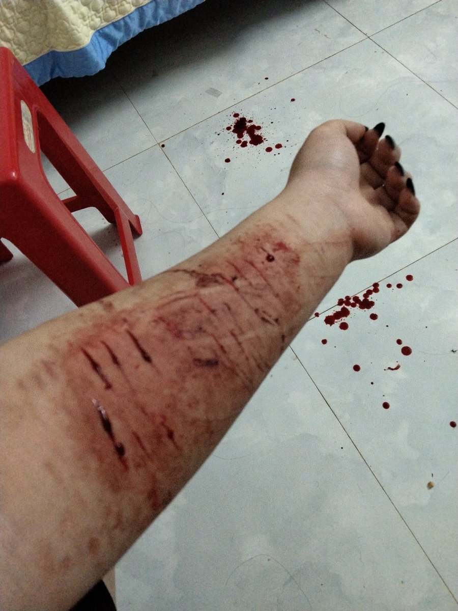 Shunn1512's tweet photo. chịu #shtwt #selfharm #vent https://t.co/jmpfIRBFZh