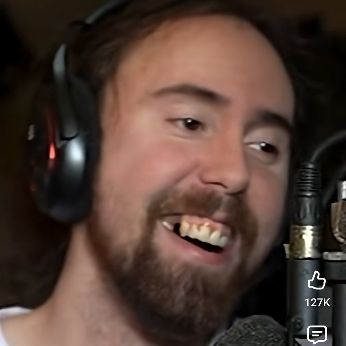 FracturedJinx's tweet photo. Imagine agreeing with this specimen's opinion. #asmongold is literally rotting from the inside out lol. How can you be loaded and let your mouth become this way. Brush your teeth. https://t.co/CdlneNlfy9