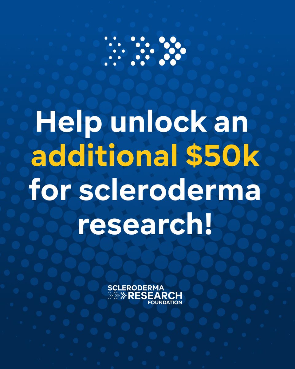 srfcure's tweet photo. The 2026 SRF Research Challenge is underway, and a new challenge just raised the bar to make an impact! 🔬

If 50 people make a gift this week, an additional $50,000 will be unlocked for scleroderma research.

Help unlock $50k for scleroderma research: https://t.co/x35Gi7k6CC https://t.co/NQpbwbqk2w