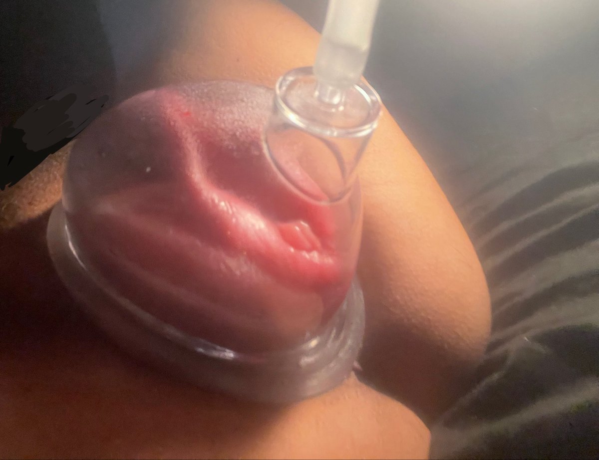 fakebxypuss's tweet photo. pussy pumping is the best to fix fakeboys, it made me love my pussy and im obsessed with looking more like a fleshlight.  I want to get bigger so I can’t escape the biological reality of my body.

#ftmtf #fakeboy #pussypumping #pumping #detrans #detranskink #ftmgirl #cuntboy #ftm https://t.co/qnb2MpO7fR