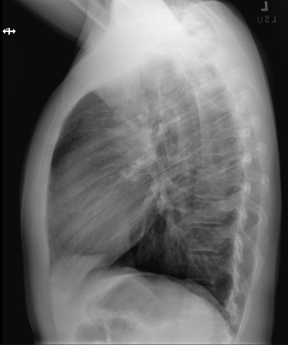 rgkuzma's tweet photo. Unfortunately nothing is wrong with my hot sexy lungs https://t.co/fae4w4yTWp