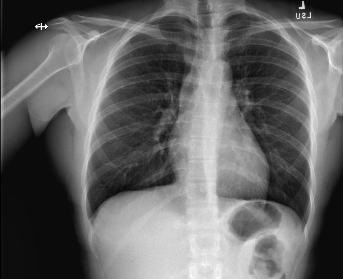 rgkuzma's tweet photo. Unfortunately nothing is wrong with my hot sexy lungs https://t.co/fae4w4yTWp