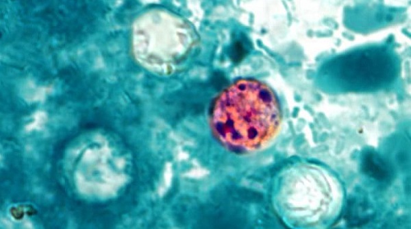 Complex's tweet photo. There is a parasite outbreak that is causing explosive diarrhea in the U.S 😳
The CDC says at least 145 people in 20 states have gotten sick from the parasite Cyclospora, with 20 people hospitalized and no reported deaths.
📸:CDC https://t.co/2MAEt1ZMJK