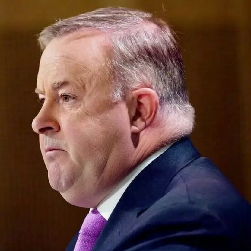 Ausbobsmit's tweet photo. Albanese hates it when they capture him side on. https://t.co/G4tSomfds5