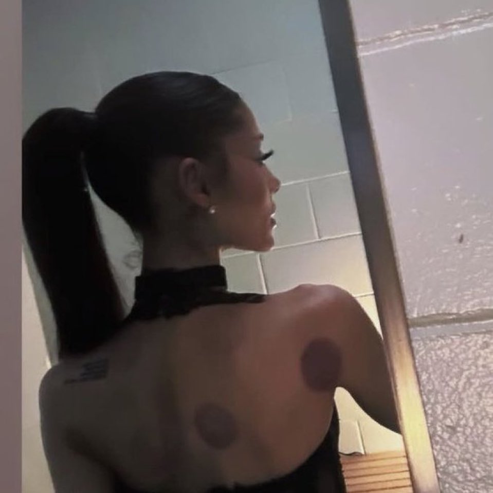 opserickk's tweet photo. @arianagrandebr ela já tendo que avisar que isso é marca de massagem antes do show pra dps o povo não ficar falando que é marca do sexo dela com o ricky https://t.co/ZP7h3mdeYa