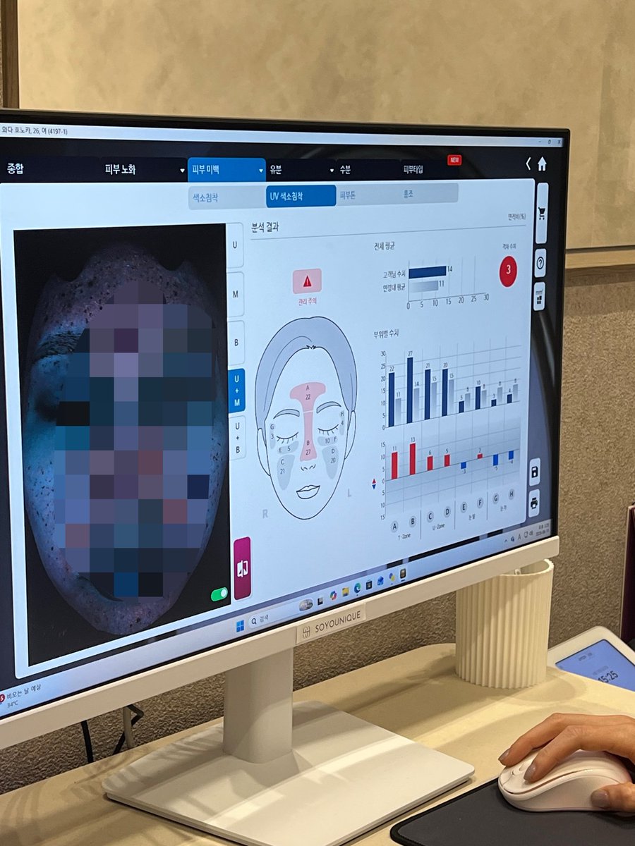 honobono_99's tweet photo. @soyouclinic_j でお手入れしてきた👀

スタッフの方もとても親切で悩みを全部言ったら、まず自分がやらないけないことを説明してくれて今回は毛穴の部分を重心的にしたよん💖

●カスタムピーリング
●LDM
●アストロ酸素ドーム

絶対また行く。リピ確定‼️
#ソユクリニック #韓国美容 #韓国旅行 https://t.co/AxOpauffs0