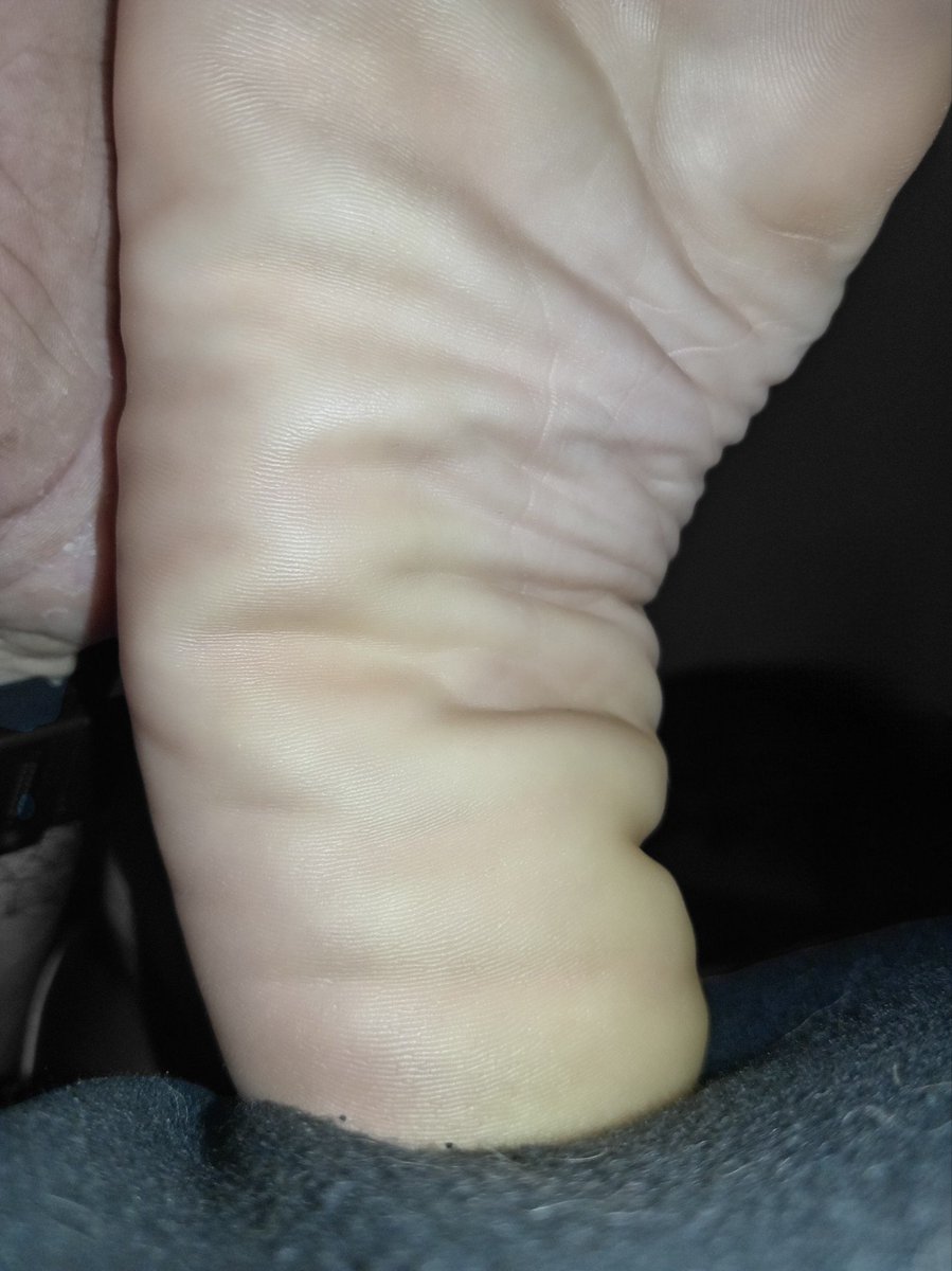 carminafeet12's tweet photo. Plantitas y Arrugas les desea Feliz Noche 👣🤗😘 #pies #piessudados #olor #oloraqueso #piesudados #dedos #dedogordo #deditos #footfetısh #feetfetısh #natural #foot #closeup #soles #plantadelospies #plantas #arrugas #dedosapretados #pedicure #rojo #fetiche #fetichistas https://t.co/3ll6yAAFVx
