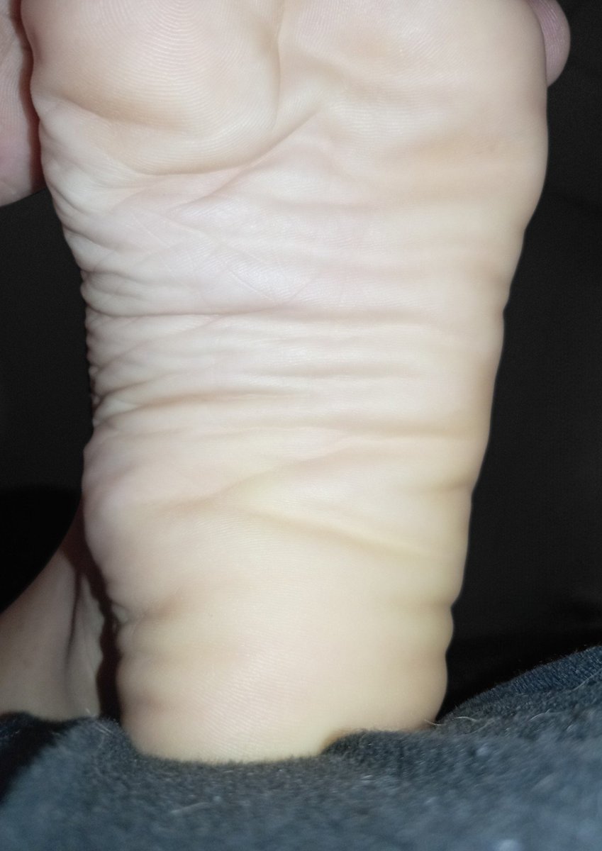 carminafeet12's tweet photo. Plantitas y Arrugas les desea Feliz Noche 👣🤗😘 #pies #piessudados #olor #oloraqueso #piesudados #dedos #dedogordo #deditos #footfetısh #feetfetısh #natural #foot #closeup #soles #plantadelospies #plantas #arrugas #dedosapretados #pedicure #rojo #fetiche #fetichistas https://t.co/3ll6yAAFVx