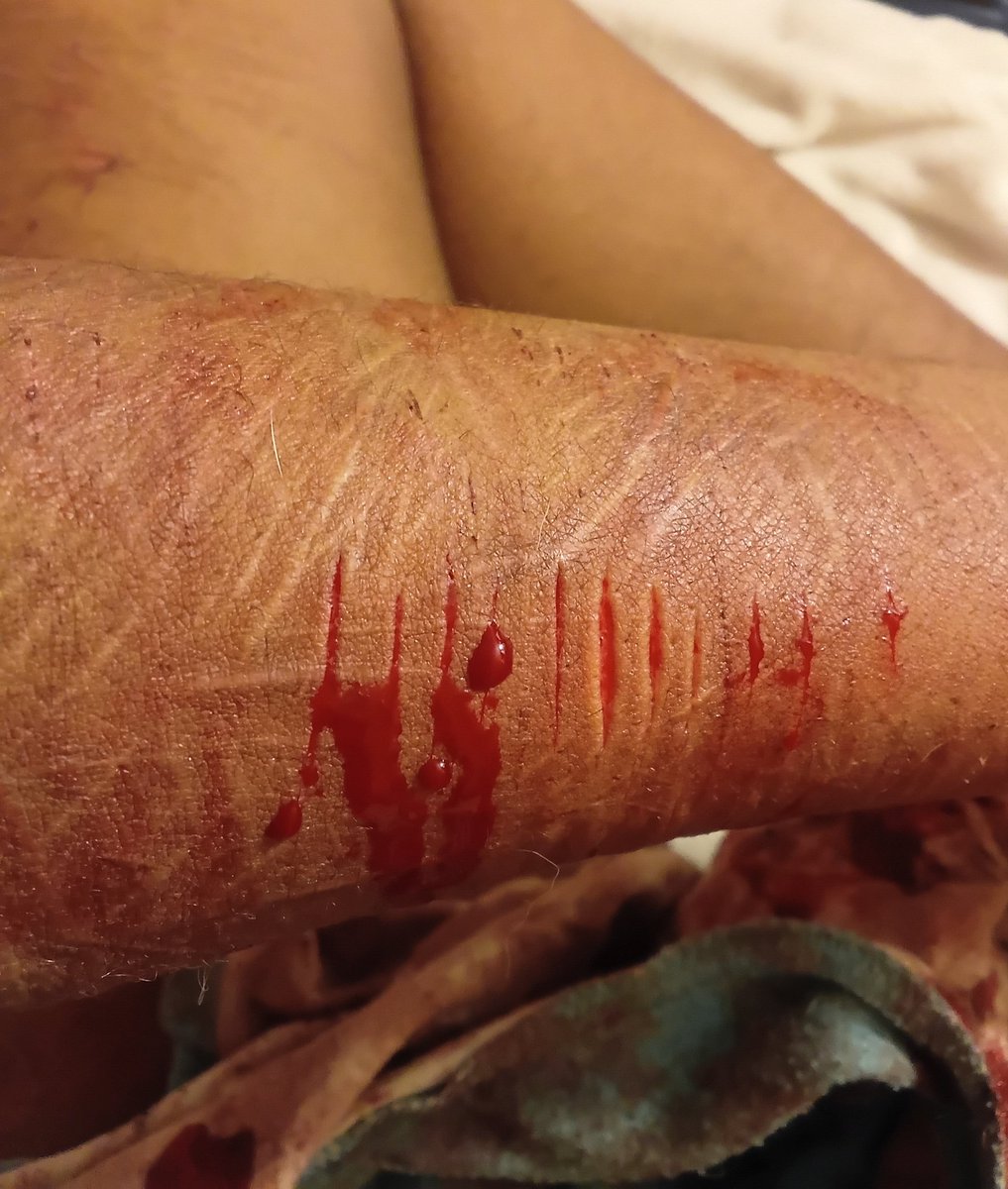 Mellzyyy_luvv's tweet photo. Never back down never what!!????
#cuttwt #slittwt #ouchietwt #styro #styrocut #sfx #makeup #fakeblood #sharm #sharmtwt #cut #sh ALL FAKE SFX MAKEUP NOT REAL ALL AI AND MAKEUP DONE BY PROFFESSIONALS https://t.co/gVBh1ohY18