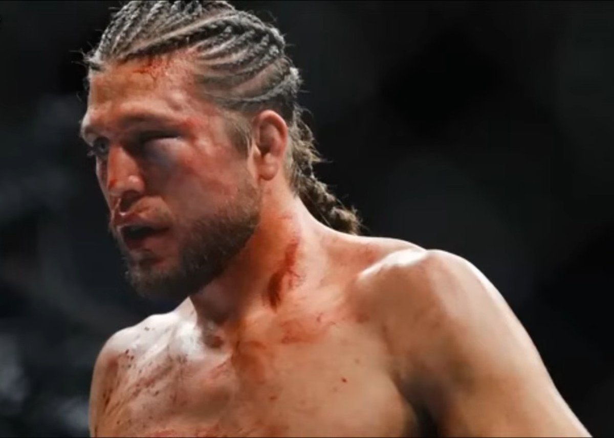 ElmuchachoFinal's tweet photo. @dortotuzalti This was Brian Ortega 1 week before and after Holloway fight https://t.co/g6XTqVewmY