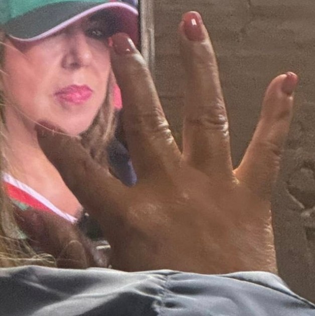 erickrex00's tweet photo. @LuisCardenasMx Que pedo con sus pezuñas?? Parecen de peli de terror 😱😱 😱 https://t.co/IIDpDTglEK
