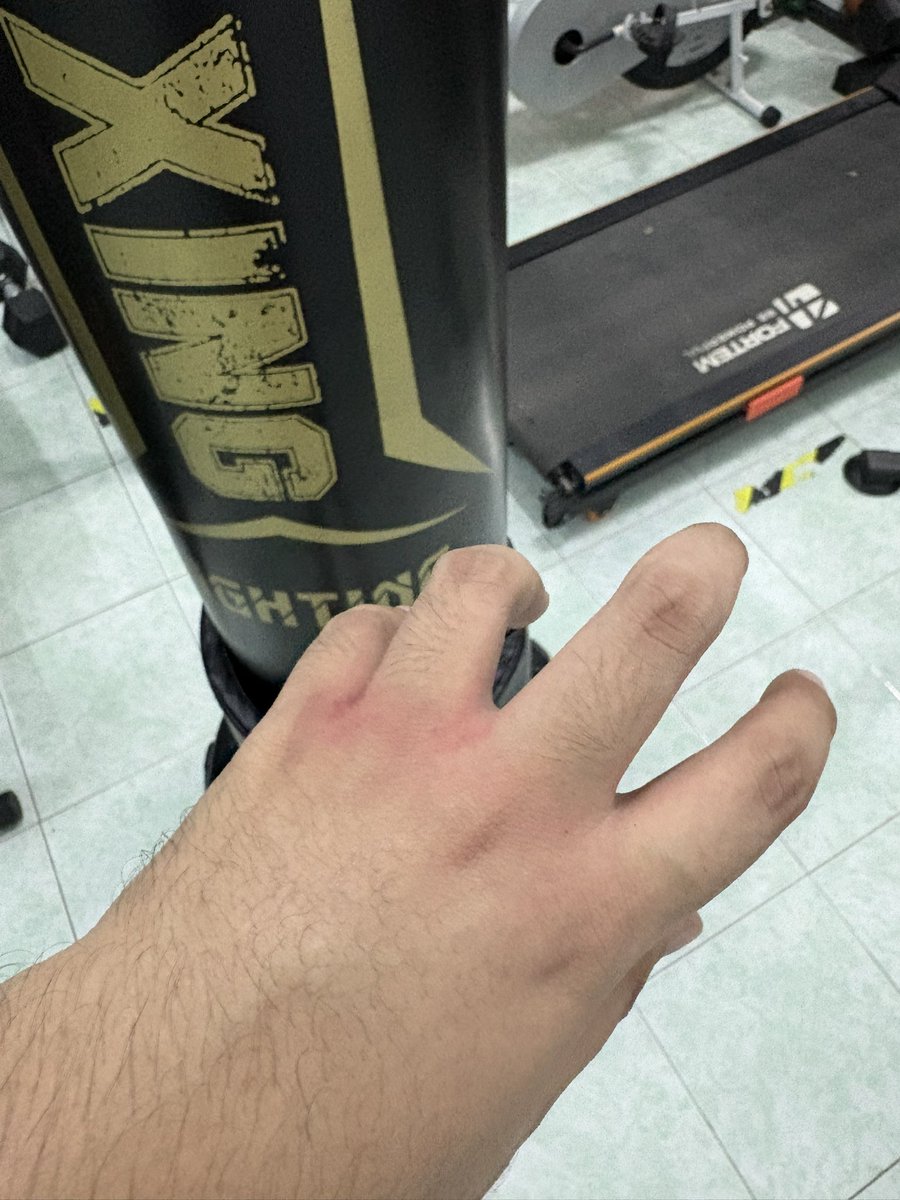 Sheeeeeezzzzzz's tweet photo. ซ้อมมวยอาทิตย์แรก มือแตกครับ☺️ https://t.co/jcAMvBYelm