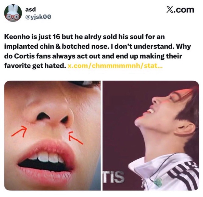 touchdatgrass's tweet photo. @taraencortis Imagine being so chopped pre debut the company had to invest in a new nose, jaw, chin and bleach ur skin 🥀 https://t.co/1hWK1JW0vd