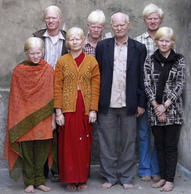 Rainmaker1973's tweet photo. This is what an albino family from India looks like https://t.co/gRD9xsMz69