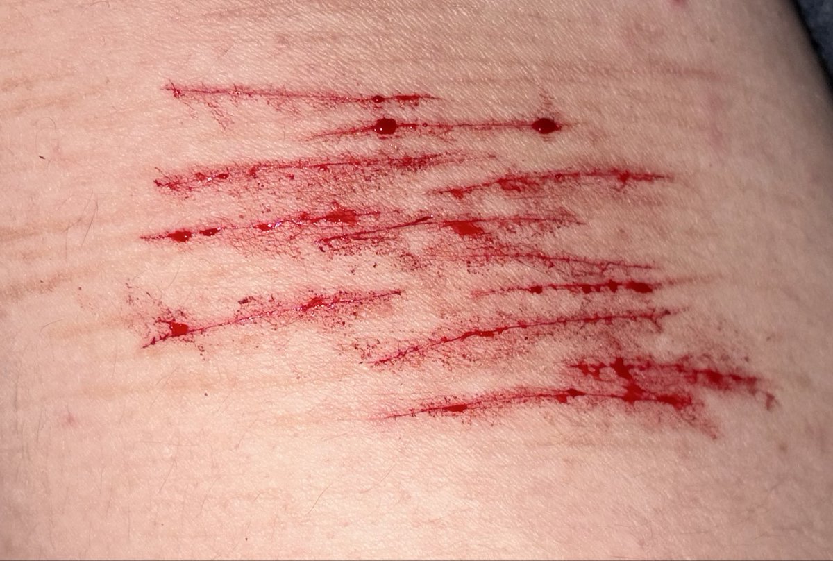 multiswix's tweet photo. Babiest baby styros I have ever done because I was just testing my blade AND IM HAVING THE WORST STOMACH CRAMPS EVER OMD I’m hunched over bleeding on my shirt and gripping my stomach please put me down https://t.co/iIu6uayOi6