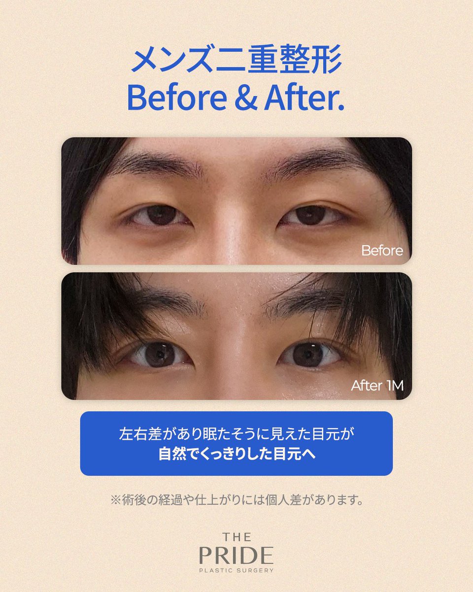 【公式】ザ•プライド美容外科 tweet media