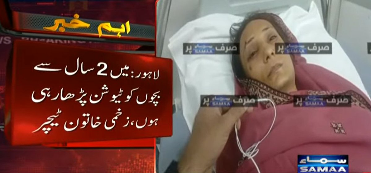 SAMAATV's tweet photo. لاہور کے علاقے کاہنہ میں ٹیوشن سینٹر کی چھت گرنے کے واقعے میں زخمی خاتون ٹیچر نے سماء سے گفتگو میں بتایا کہ بارش سے چھت ٹپکتی تھی، جس کی وجہ سے مرمت کا کام شروع کیا گیا۔

خاتن نے بتایا کہ مالی حالت اچھے نہیں ہیں جس کی وجہ سے ٹیوشن پڑھاتی ہوں، مجموعی طور پر 30 سے 35 بچے پڑھنے آتے ہیں، گزشتہ روز 20، 22 بچے آئے تھے۔

زخمی خاتون ٹیچر نے مزید کہا کہ میرے شوہر منڈی کے پاس ریڑھی لگاتے ہیں، چند سو روپے کی بچت ہوتی ہے، 2 سال سے بچوں کو ٹیوشن پڑھا رہی ہوں۔

#SamaaTV #Pakistan #punjab #lahore #RoofCollapse #LadyTeacher #femaleteacher