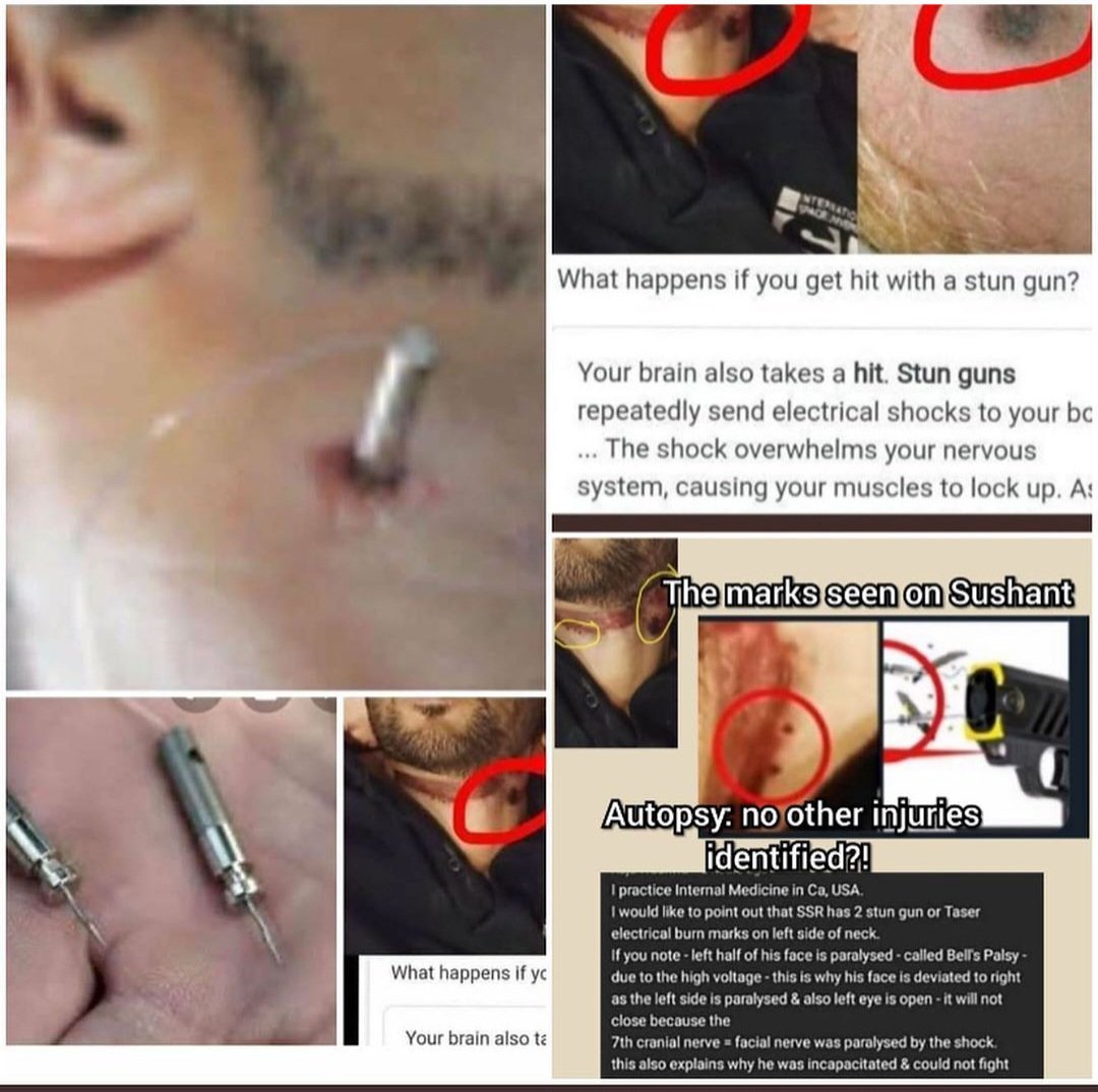 Yasmin2186's tweet photo. "They have used stun gun on Sushant to lock his muscles & incapacitate him so they can easily kill him & he can't fight back because affects of stun gun slows down after 1 hour." — U.S. Doctor

Killérs knew what Sushant was capable of that's why Vaze used stun gun on him otherwise he had so much strength he alone wuld have taken down 5-6 people. 

The high-voltage electric shock from stun gun broke all his bones. God he must have gone through so much pain💔 I Am Sushant I Want Justice 
#JusticeForSushantSinghRajput