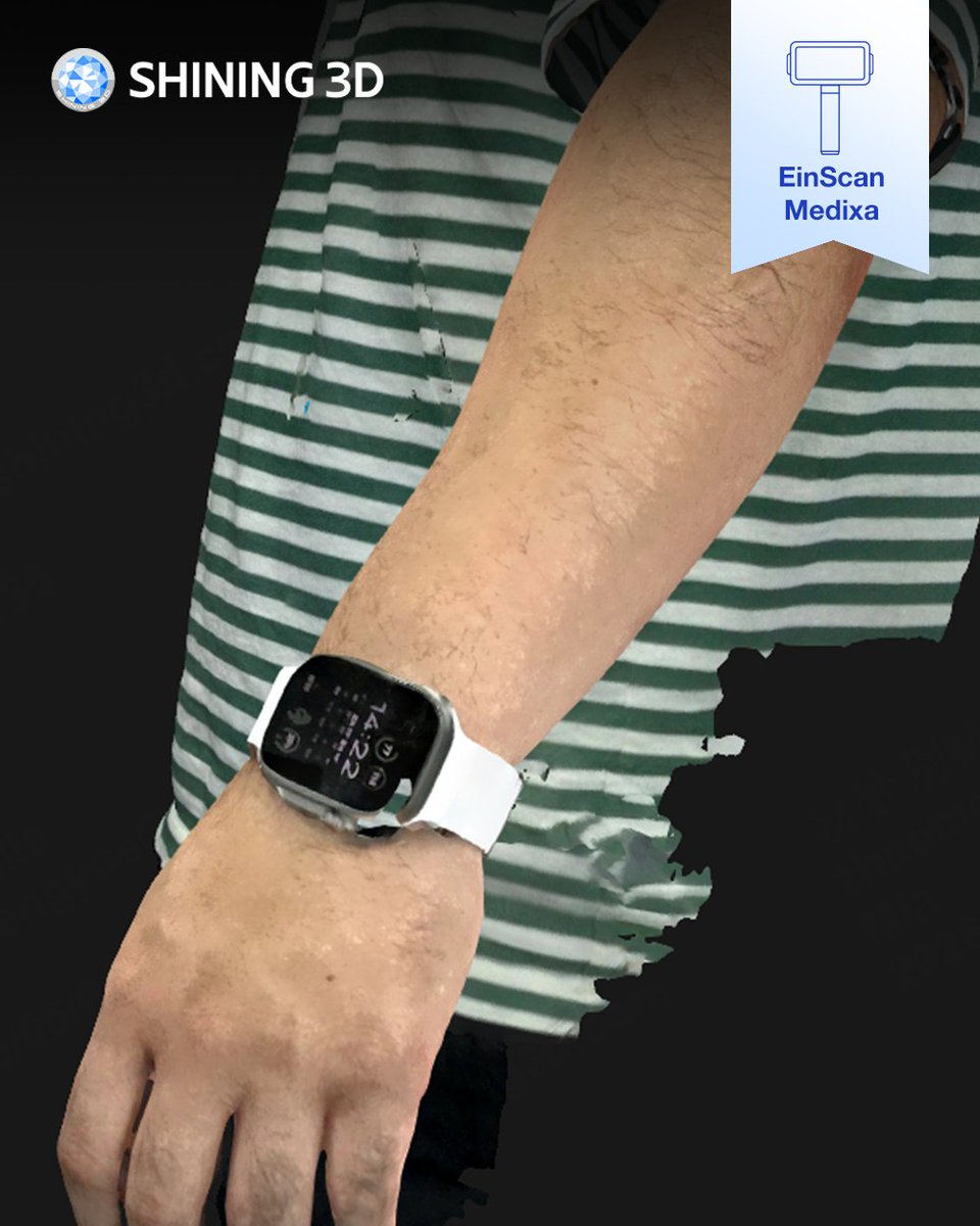 Shining3D's tweet photo. 🦾 An arm. Scanned in color. No plaster. No mess.
Meet #EinScanMedixa — built for #OandP.
📦Wireless · All-in-one · Contact-free
🎯5MP texture · Dual light sources
⚡️80% reduction in time
Preset workflows, zero guesswork.
This is O&amp;P care, digitized.

👇See scan data in comments. https://t.co/l0eu1dDJSG