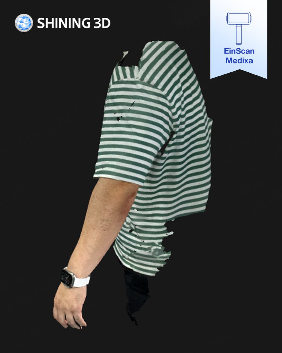 Shining3D's tweet photo. 🦾 An arm. Scanned in color. No plaster. No mess.
Meet #EinScanMedixa — built for #OandP.
📦Wireless · All-in-one · Contact-free
🎯5MP texture · Dual light sources
⚡️80% reduction in time
Preset workflows, zero guesswork.
This is O&amp;P care, digitized.

👇See scan data in comments. https://t.co/l0eu1dDJSG