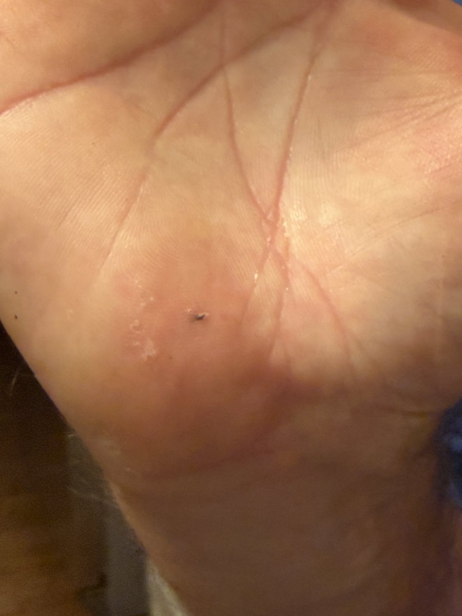 MarinaTHardy's tweet photo. American Master Tradesman Bill survived decades of turning a wrench … only to be taken down by a French STAUB pot on the eve of July 4. 

@Zwilling_ES , we need to chat. An enamel shard broke off our ~2021 Dutch oven during hand washing and managed to puncture his hand. We’d love to have you take a look.