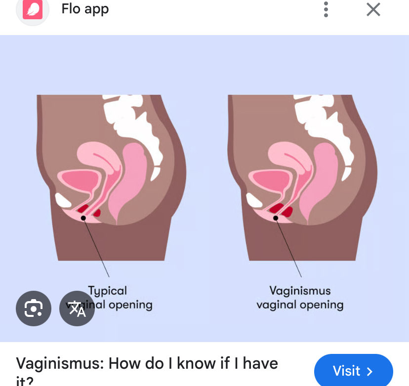 twitnyapimma's tweet photo. izin menambahkan ya kak,
vaginismus itu bukan lebay dan bukan cuma "takut aja".

ada 2 tipe vaginismus: - primer : dari pertama kali emang belum pernah bisa penetrasi. - sekunder: dulunya bisa, terus jadi susah karena trauma, melahirkan, infeksi, menopause, atau pengalaman buruk.

gejalanya juga gak cuma pas seks.. bisa kerasa pas pemeriksaan dalam ke dokter, saat pakai menstrual cup atau tampon, bahkan saat masukin jari sendiri.

yg terjadi sebenarnya adalah otot dasar panggul mengencang otomatis (di luar kendali) karena tubuh masuk ke siklus takut trs jd tegang dan akhinya terasa sakit. 

jd ini bukan sesuatu yang bisa "dipaksa santai"… dan biasanya pengobatan yang bisa dilakukan kaya:
 - vaginal dilator (bertahap, dengan panduan tenaga kesehatan) - kerjasama dr dokter kandungan + fisioterapis dasar panggul + bila perlu terapis seks
- kadang ditambah latihan relaksasi atau biofeedback.

btw kondisi ini dialami sekitar 1–7% perempuan, tapi banyak yang gak terdiagnosis karena masih dianggap tabu.