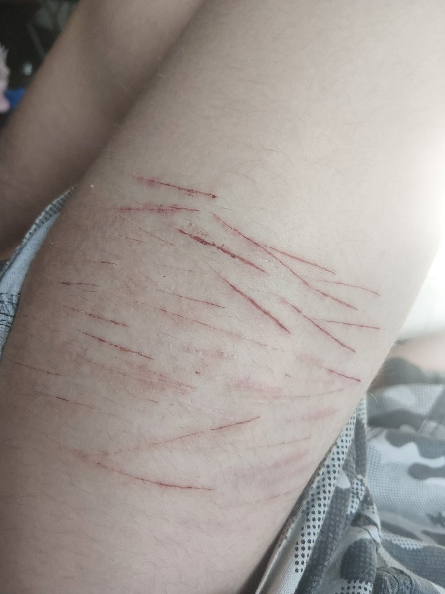Sylvieon_5's tweet photo. I've been cutting a lllooott recently but never actually having a chance to take pics so have these I took yesterday most of them r fresh #sh #shtwt #slit #slittwt #styro #owchie #sfx #notreal #fake https://t.co/OYONwZgzOh
