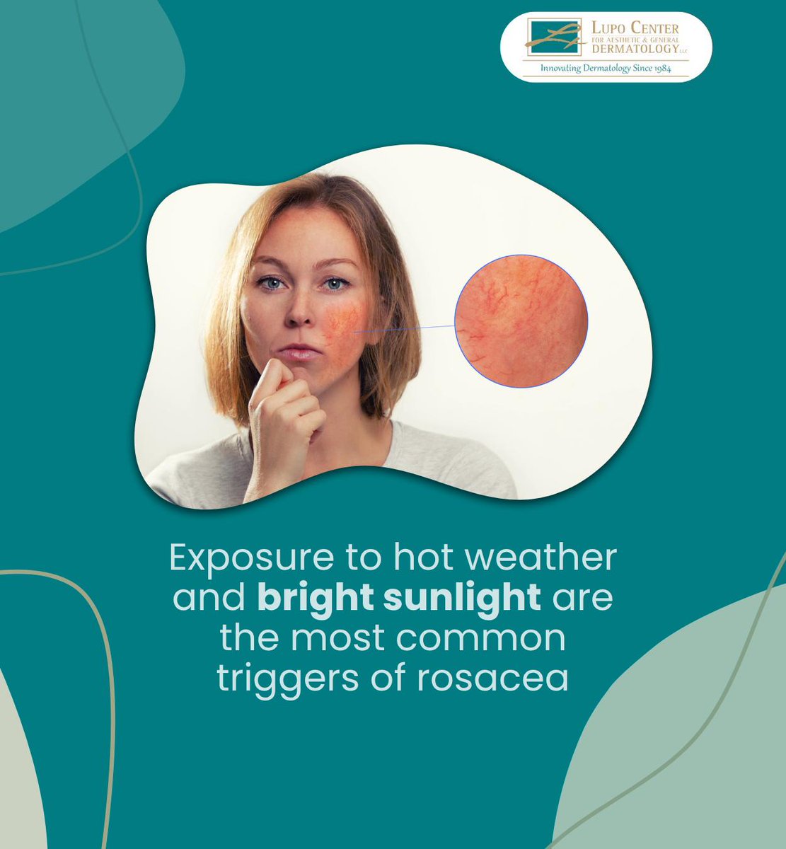 LupoDermatology's tweet photo. Have you experienced this? Small steps like avoiding direct sunlight, covering up with hats and sunglasses, and staying cool with water can help reduce rosacea flare-ups and protect your skin. #rosacea #rosaceatriggers #neworleans #LA #lupocenter https://t.co/hzsyNlEweh