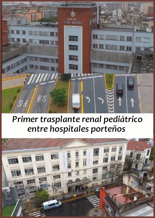 palermomio's tweet photo. Primer trasplante renal pediátrico entre hospitales públicos porteños: el Gutiérrez y el Argerich operaron en simultáneo a un chico de 9 años y a su papá, donante del riñón. El traslado del órgano tardó 12 minutos.

https://t.co/2JmjTmMu8o https://t.co/Ptx10QUYIl